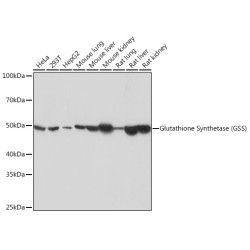 Glutathione Synthetase (GSS) Rabbit mAb