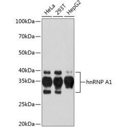 hnRNP A1 Rabbit mAb