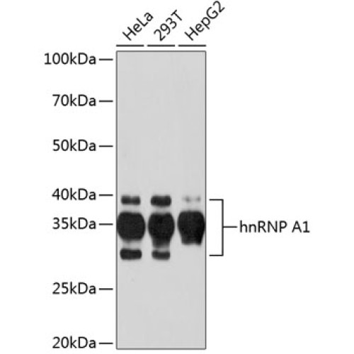 hnRNP A1 Rabbit mAb