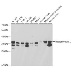 Tropomyosin 1 Rabbit pAb