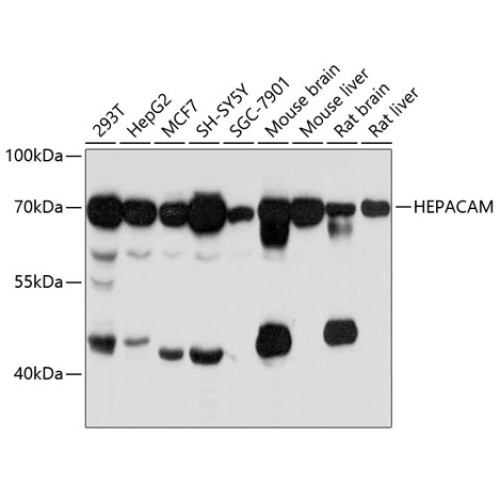 HEPACAM Rabbit pAb