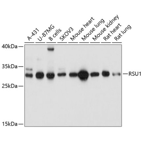 RSU1 Rabbit pAb