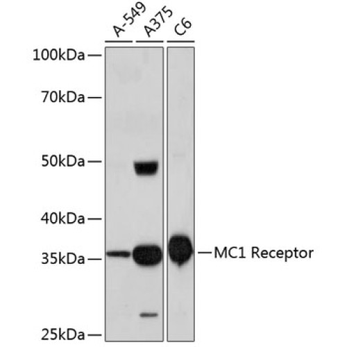 MC1 Receptor Rabbit mAb