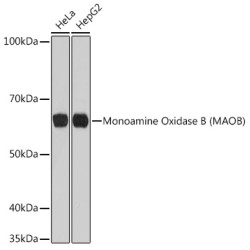 Monoamine Oxidase B (MAOB) Rabbit mAb