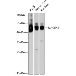 MAGEA4 Rabbit pAb