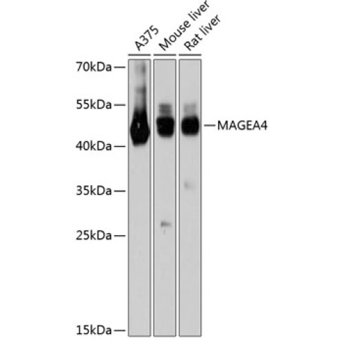 MAGEA4 Rabbit pAb
