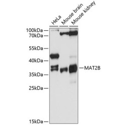 MAT2B Rabbit pAb