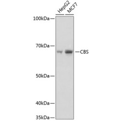 CBS Rabbit mAb