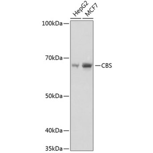 CBS Rabbit mAb