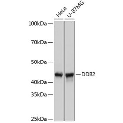DDB2 Rabbit mAb