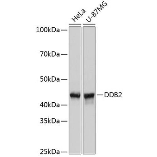 DDB2 Rabbit mAb