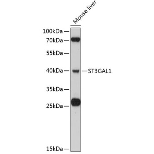ST3GAL1 Rabbit pAb