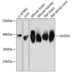 ALDOC Rabbit pAb
