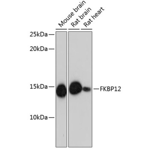 FKBP12 Rabbit mAb