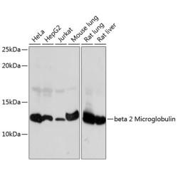 beta 2 Microglobulin Rabbit mAb