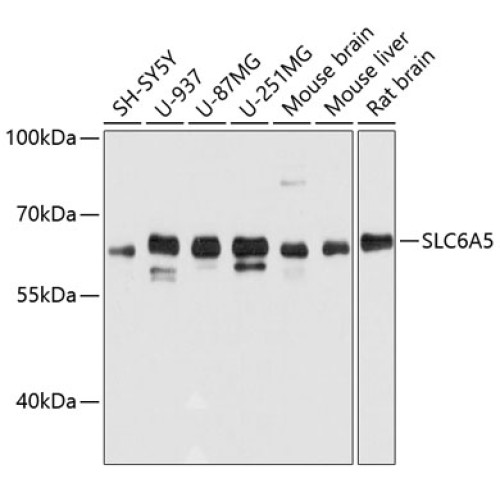 SLC6A5 Rabbit pAb