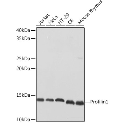 Profilin1 Rabbit pAb