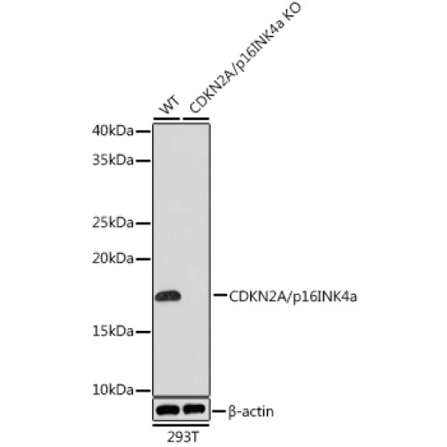 [KO Validated] CDKN2A/p16INK4a Rabbit mAb