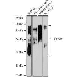 [KO Validated] IFNGR1 Rabbit mAb