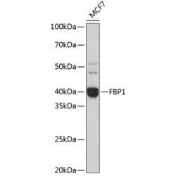 FBP1 Rabbit mAb