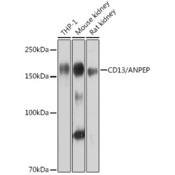 CD13/ANPEP Rabbit mAb