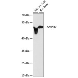 SMPD2 Rabbit pAb