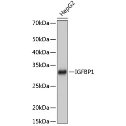 IGFBP1 Rabbit mAb