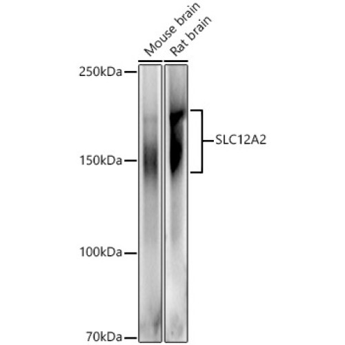 SLC12A2 Rabbit pAb
