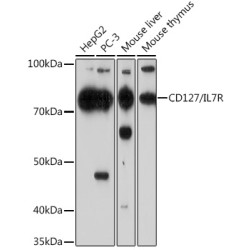 CD127/IL7R Rabbit mAb