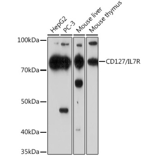 CD127/IL7R Rabbit mAb