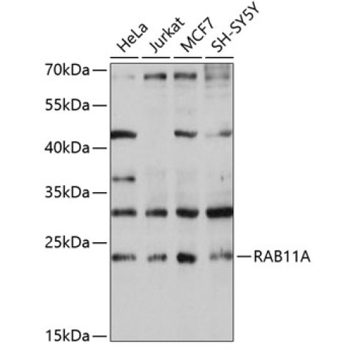 RAB11A Rabbit pAb