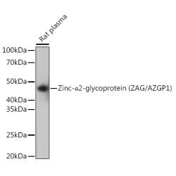 Zinc-α2-glycoprotein (ZAG/AZGP1) Rabbit mAb