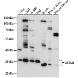OSTM1 Rabbit pAb