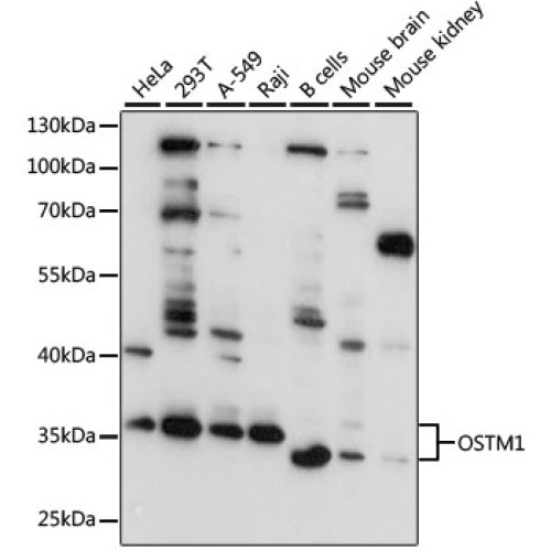 OSTM1 Rabbit pAb