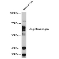Angiotensinogen Rabbit mAb