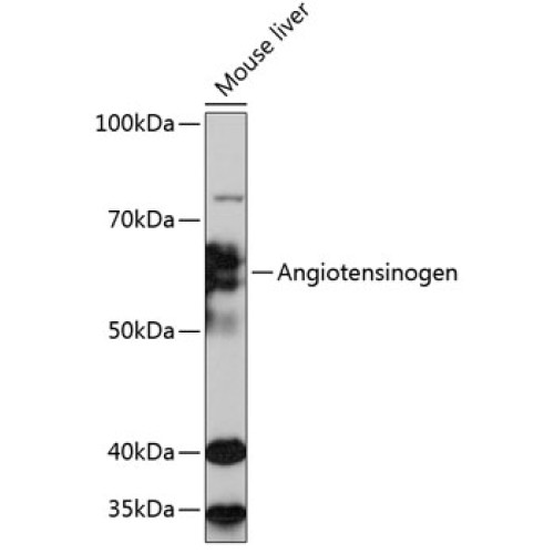 Angiotensinogen Rabbit mAb