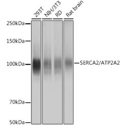 SERCA2/ATP2A2 Rabbit mAb