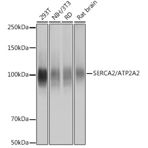 SERCA2/ATP2A2 Rabbit mAb
