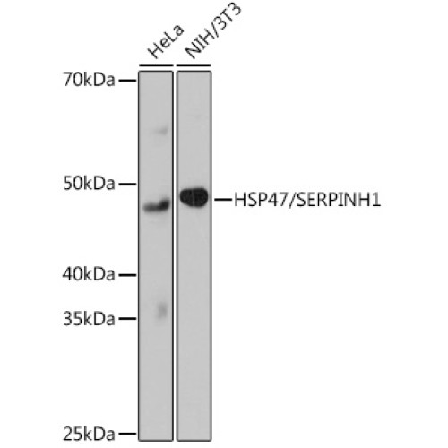 HSP47/SERPINH1 Rabbit mAb