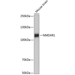 NMDAR1 Rabbit mAb