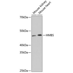 HMBS Rabbit mAb