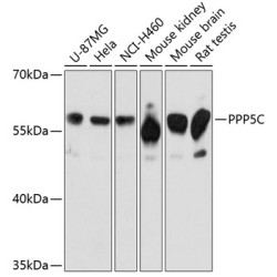 PPP5C Rabbit pAb