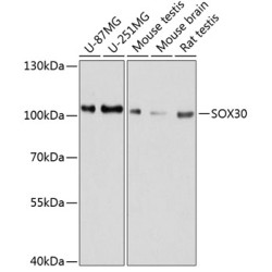 SOX30 Rabbit pAb