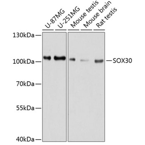 SOX30 Rabbit pAb