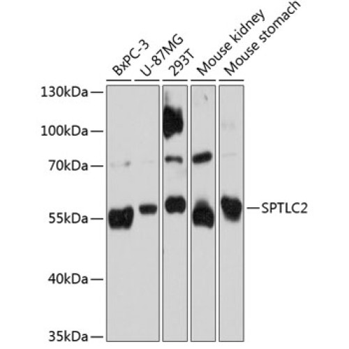 SPTLC2 Rabbit pAb