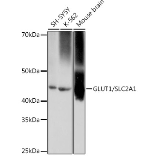 GLUT1/SLC2A1 Rabbit mAb
