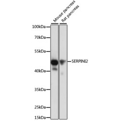 SERPINI2 Rabbit pAb