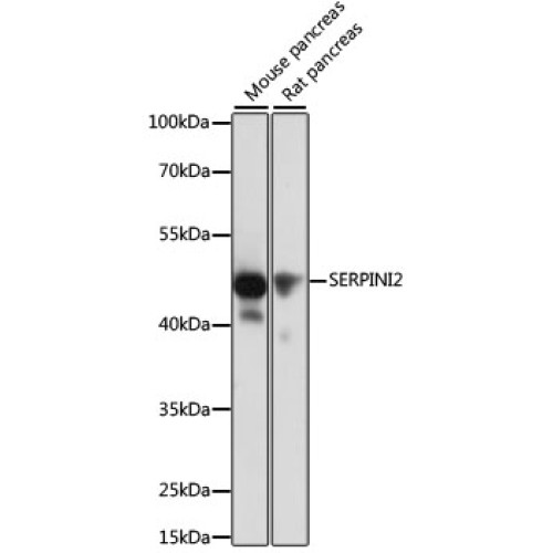 SERPINI2 Rabbit pAb