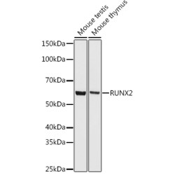 RUNX2 Rabbit mAb
