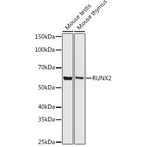 RUNX2 Rabbit mAb